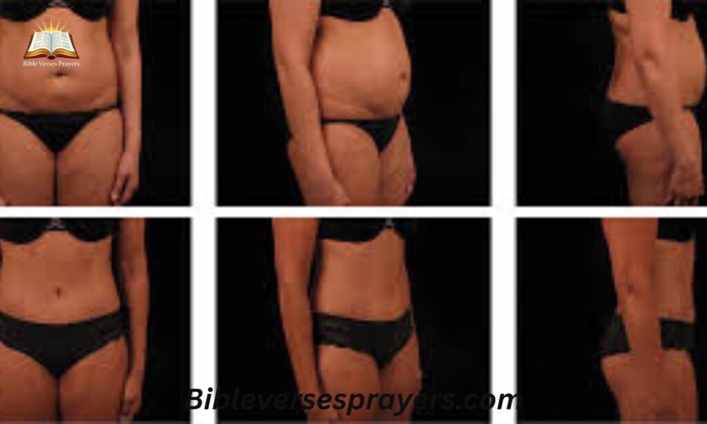 Can You Get Rid of FUPA?